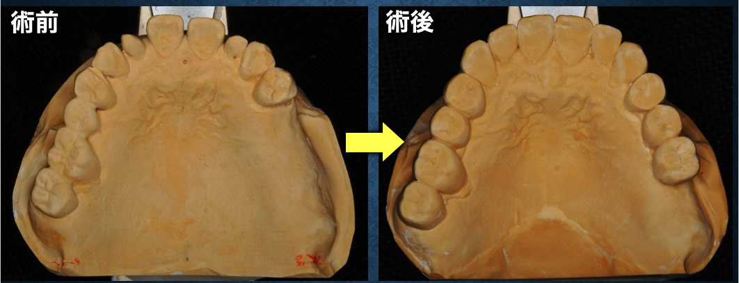 模型比較