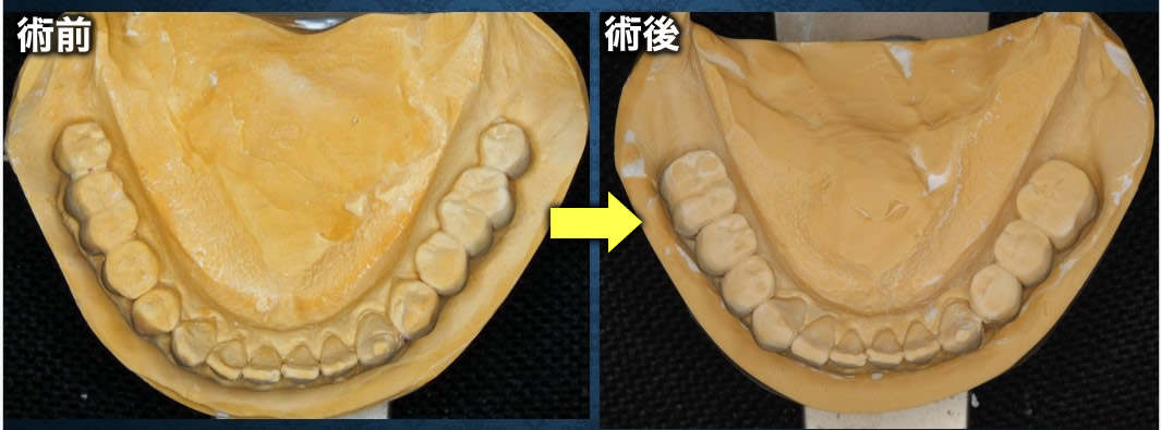 模型比較