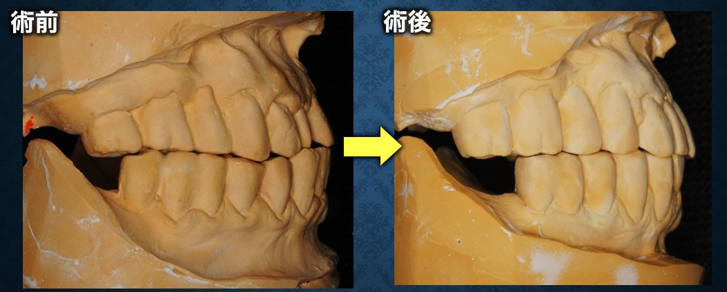 模型比較