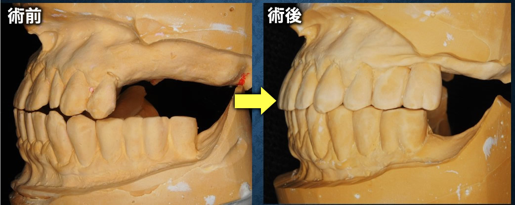 模型比較