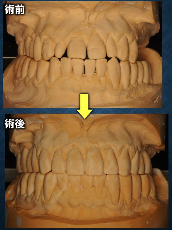 模型比較