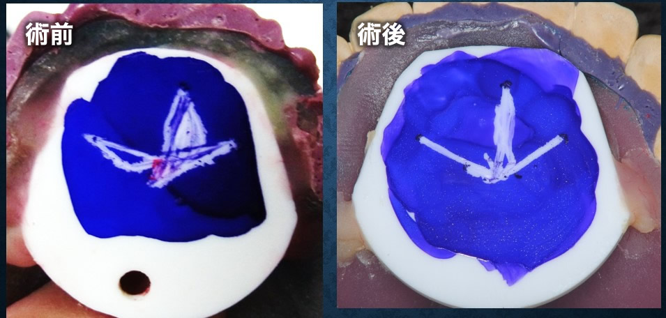 術前