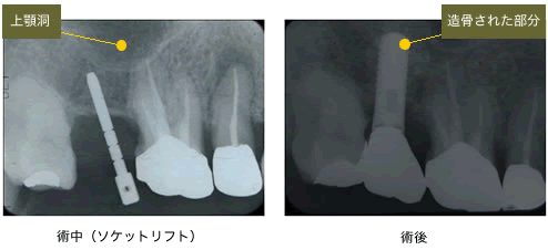 欠点