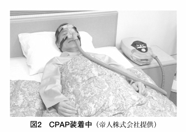 図2：CPAP装着中
